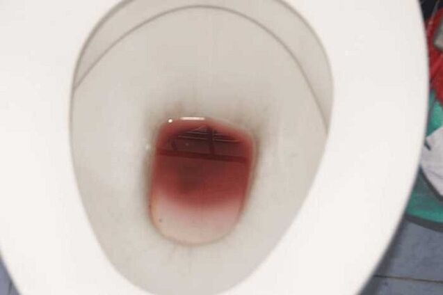 男性兴奋时出现斑点