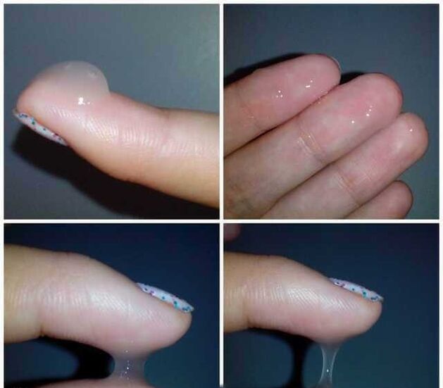 男性性兴奋时的前精液